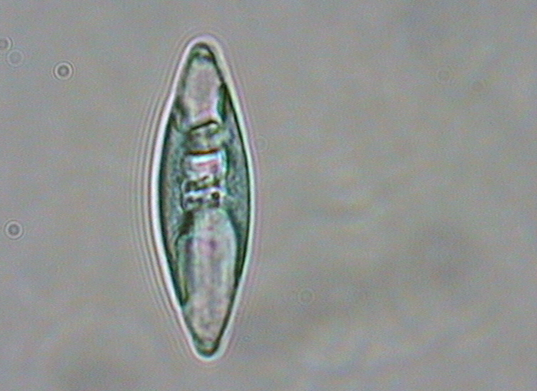 Dictyocha speculum